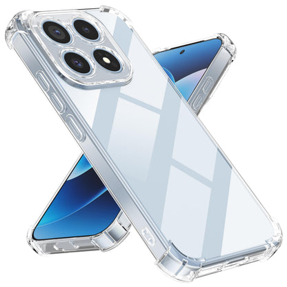 Tentoki Crystal Clear Case for Xiaomi 17