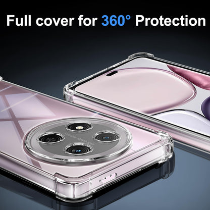 Tentoki Crystal Clear Case for Honor Magic 7 Lite