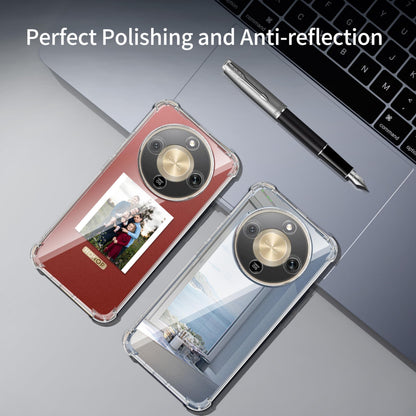 Tentoki Crystal Clear Protection Kit for Honor Magic 8 Lite - Case + 2 HD Glass