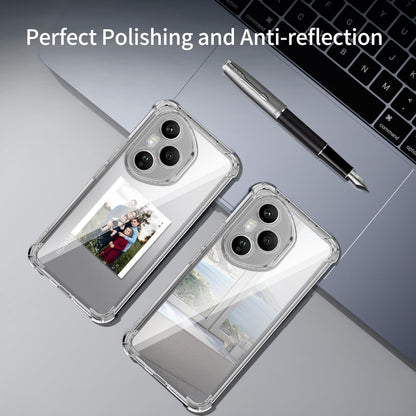 Tentoki Crystal Clear Case for Honor 400 Pro 国外版
